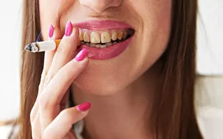 10 Tips Menjaga Mulut Tetap Sehat bagi Perokok